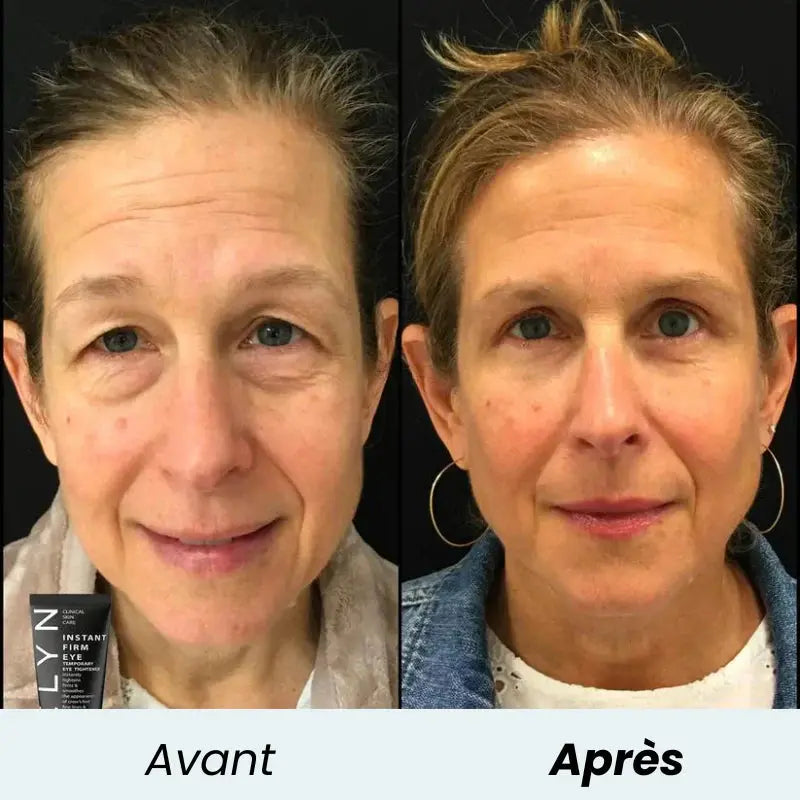 Crème Anti-Cernes Instantanée - CELYN GLORYSKIN