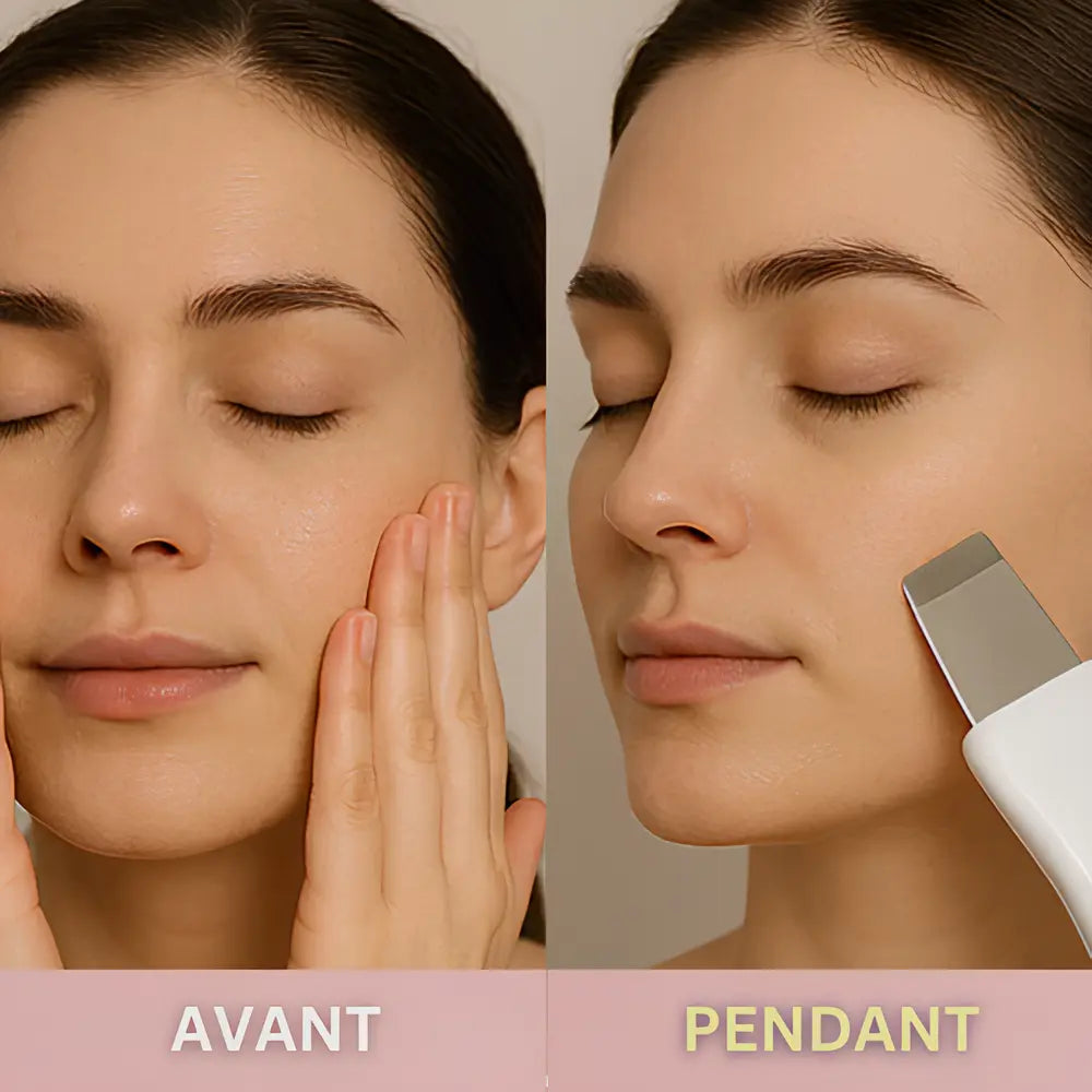 Le GloryCleaner™ – Épurateur de Peau à Ultrasons GLORYSKIN