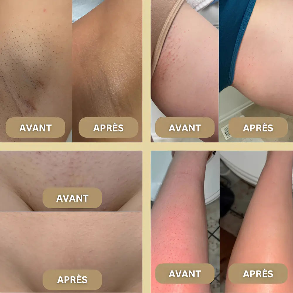 Le GloryShaver™ – Épilateur GlorySkin GLORYSKIN