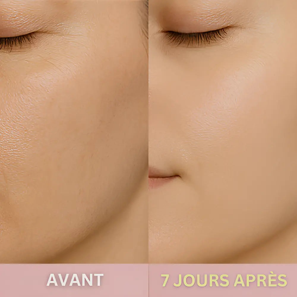 Le GloryCleaner™ – Épurateur de Peau à Ultrasons GLORYSKIN