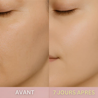 Le GloryCleaner™ – Épurateur de Peau à Ultrasons GLORYSKIN