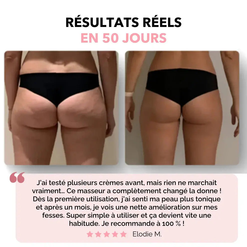 Le GloryBody™ - Masseur Anti-Cellulite GLORYSKIN