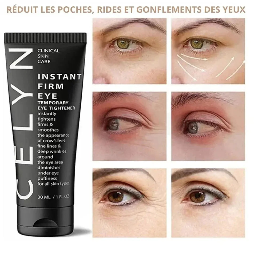 Crème Anti-Cernes Instantanée - CELYN GLORYSKIN