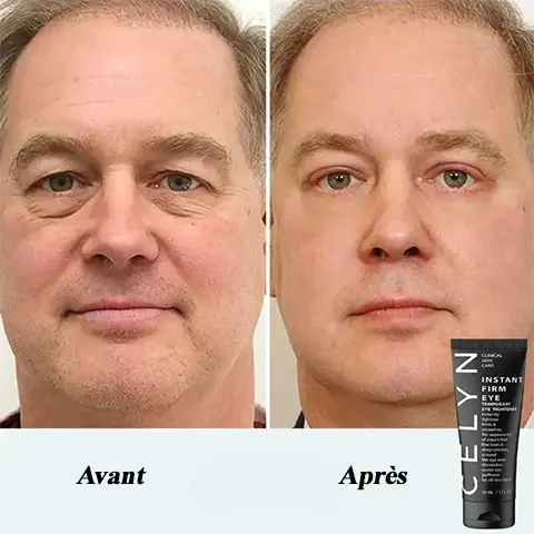 Crème Anti-Cernes Instantanée - CELYN GLORYSKIN