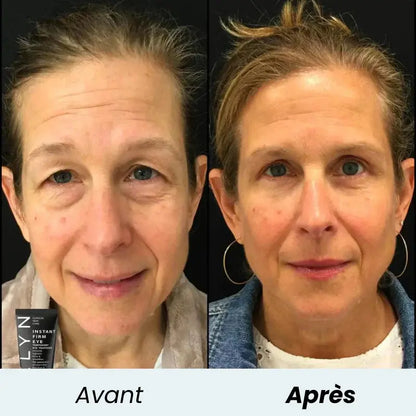 Crème Anti-Cernes Instantanée - CELYN GLORYSKIN